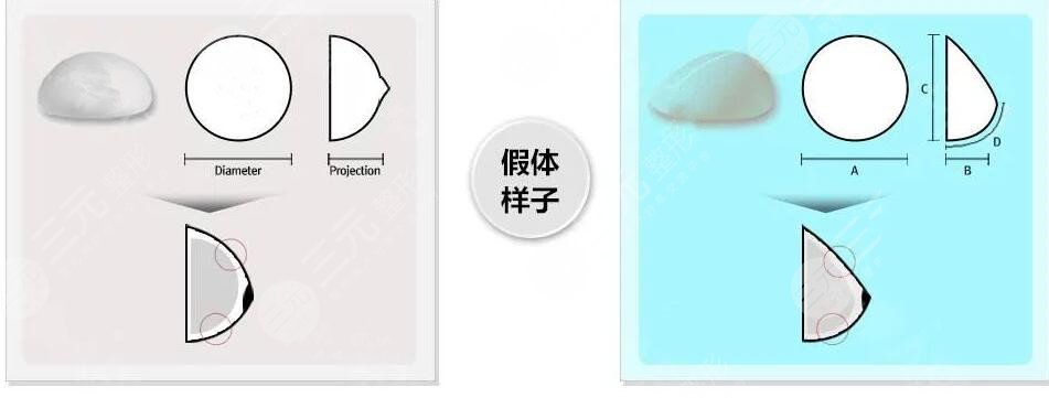 假體隆胸的材料什么牌子好?