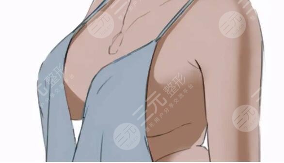 運(yùn)動(dòng)豐胸