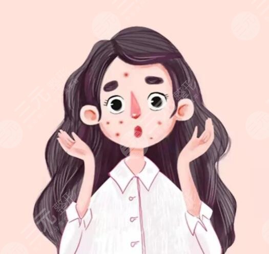 復合彩光去痘幾次有？復合彩光去痘的原理和果解析，網友打卡后反饋~