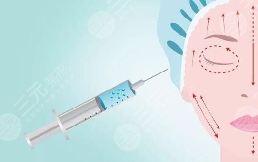 注射除皺
