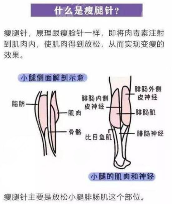 肌肉小腿怎么瘦成筷子腿肚子？
