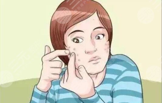 祛痘印的有方法有哪些？小妙法哪種更有果？從專業(yè)角度幫你解析~