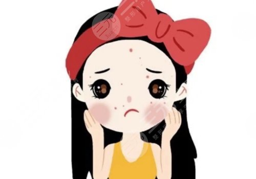 去痘價(jià)格大概多少?