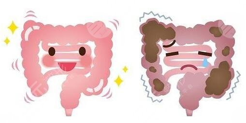 清腸道排宿便有的方法有哪些?