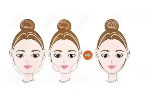 泉州豐澤美萊華美醫(yī)療美容門診部坐診醫(yī)生介紹：