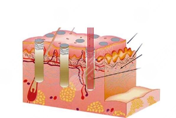 復(fù)合彩光祛痘需要多少錢(qián)?