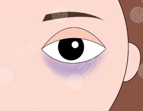 　　吃什么緩解黑眼圈果好又快速?黑眼圈可以說是我們的災(zāi)難，稍微不注意黑眼圈就悄悄的冒了出來，即便擁有一張白皙靚麗的臉龐也忍受不了黑眼圈的出現(xiàn)，黑黑的黑眼圈一旦出現(xiàn)在臉上，就會讓我們看起來沒有精神，整個(gè)人焉了吧唧的。為了解決免不黑眼圈的問題，大家各種各樣的方法都是使用，目前使用的比較多的是使用各種各樣的眼霜，或者是通過醫(yī)美整形的方式來改良，又或者是通過飲食的改變來改良黑眼圈的問題，那么吃什么緩解黑眼圈?現(xiàn)在就和小編一起來認(rèn)真的做一下功課吧!  　　一、黑眼圈是怎么出現(xiàn)的?  　　黑眼圈出現(xiàn)的原因有很多種，比較常見的一種是長時(shí)間的熬夜，導(dǎo)致眼部疲勞血液流通不暢，出現(xiàn)了紫紅色或者是青色的黑眼圈。還有一種是色素性黑眼圈，出現(xiàn)這種情況的原因有很多中，不單單是因?yàn)榘疽箤?dǎo)致的，還有一些外界因素的印象，主要指因?yàn)殚L時(shí)間在陽光下暴曬，過多的藥物攝入，做了一些眼部手術(shù)等等，以及買了一些不適合自己的化妝品，引發(fā)了眼周蕁麻疹反映，都會導(dǎo)致眼周出現(xiàn)色素沉淀，對于這種色素性黑眼圈，主要是叫撒后這些黑色的細(xì)胞，減少黑色色素。  　　二、吃什么緩解黑眼圈果好又快速?  　　既然有黑眼圈的出現(xiàn)，就要積極的找到一個(gè)有的緩解方式，目前就有很多人說可以通過食物來改良黑眼圈的問題。那么具體吃哪些東西比較有果了?  　　1、攝入高蛋白的食物，高蛋白的食物有很多種，主要是牛奶，雞蛋以及各種肉類，積極增加自己的蛋白質(zhì)攝入，可以有的緩解黑眼圈的形成，但是對高蛋白食物過敏的小伙伴，不建議使用這一種方法，大家可以通過其他的方式來改良自己黑眼圈的問題。  　　2、可以嘗試多吃一些動物的肝臟等食物，這些食物內(nèi)部含有為豐富的維生素a，這個(gè)維生素可以很好的為我們眼周和眼球提供必需的物質(zhì)，促進(jìn)眼周的血液循環(huán)，幫助緩解黑眼圈。同時(shí)吃各種各樣有營養(yǎng)的食物來改良黑圈，也是一個(gè)比較好的選擇，大家可以根據(jù)自身的條件來制定一個(gè)比較不錯(cuò)的食譜。  　　三、醫(yī)美整形手術(shù)改良黑眼圈  　　除了通過吃東西來改良黑眼圈以外，還有一種可實(shí)施比較有的方法，那就是通過醫(yī)美整形的方式來改良黑眼圈。目前針對黑眼圈的醫(yī)美整形項(xiàng)目也有幾個(gè)，小編整理了一些作用果不錯(cuò)的幾個(gè)項(xiàng)目，現(xiàn)在就分享給大家吧!  　　1、激光緩解黑眼圈  　　激光緩解黑眼圈是一個(gè)比較常見的醫(yī)美整形項(xiàng)目，也是當(dāng)下行之有的一種技術(shù)手段，他的操作難度不高，主要是通過激光的遠(yuǎn)紅外長脈沖激光，作用在眼周的皮膚上，慢慢的滲透到皮膚深層，讓激光產(chǎn)生的爆破光熱能量將這些黑色素打散，改良皮膚的生成代謝，促進(jìn)膠原代表的生成，在有去除黑眼圈的同時(shí)，也能樣眼周的皮膚更將光澤有彈性。這種激光緩解黑眼圈的方式一般適用于是色素性黑眼圈。  　　2、注射緩解黑眼圈  　　如果是結(jié)構(gòu)性的黑眼圈，一般采用玻尿酸或者是脂肪來進(jìn)行局部的注射填充來改良，這種黑眼圈一般是出現(xiàn)在家族遺傳病史上，隨著年紀(jì)的增加，到了十五六歲的時(shí)候就會出現(xiàn)結(jié)構(gòu)性的黑眼圈，這時(shí)候就可以采取局部注射緩解大，可以很好的減少這種情況的出現(xiàn)，既而改良黑眼圈的情況。想要通過醫(yī)美整形手段改良自己的黑眼圈情況的小伙伴，一定要去正規(guī)的整形機(jī)構(gòu)做手術(shù)，并且了解到自己出現(xiàn)黑眼圈的原因，才能制定一個(gè)可行的手術(shù)方案。