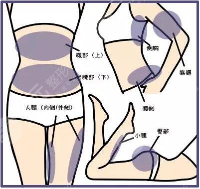 等離子激光溶脂有危害嗎？