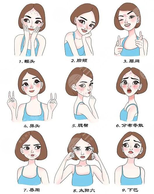 北京緩解痤瘡大概需要幾次有果?