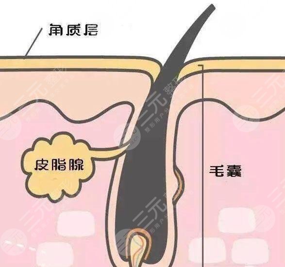 黑頭導(dǎo)出液哪個(gè)好用?