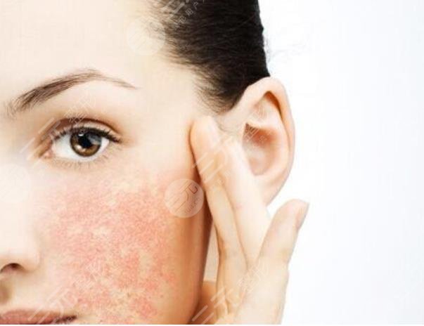 黑臉娃娃簡(jiǎn)要介紹