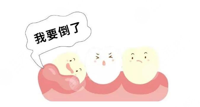 牙周炎牙齒松動(dòng)原因解析