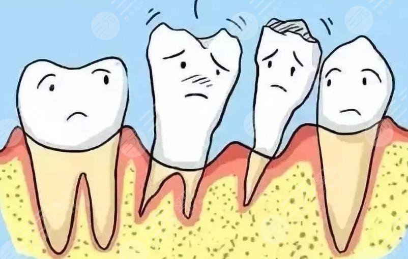 牙周炎牙齒松動(dòng)原因解析