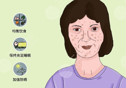 簡單美白祛斑的方法有哪些？