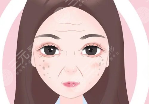 怎樣治老年斑？