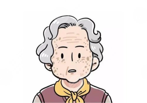 怎樣治老年斑？