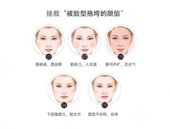 微創(chuàng)改臉型手術價?格多少?