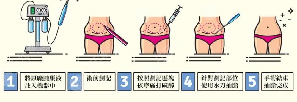 不吃藥的減肥方法1周瘦10斤怎么減?