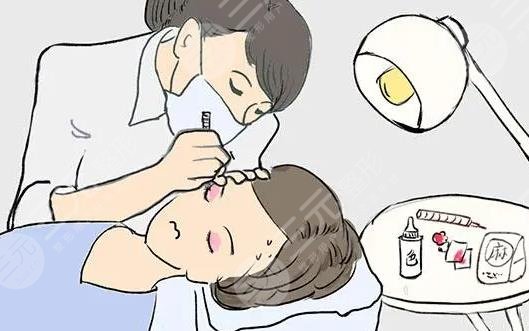 iu整容整哪里了？