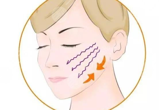 iu整容整哪里了？