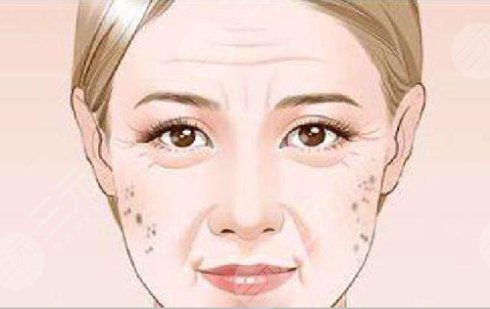 #偏方大全#怎樣治老年斑?