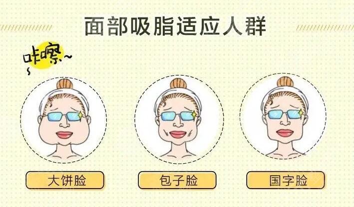 臉部抽脂的注意事項(xiàng)