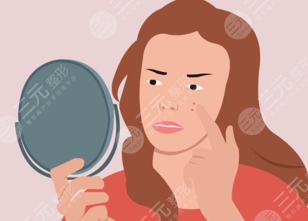 北京緩解痤瘡多少錢一個(gè)療程？針對(duì)臉上的坑坑洼洼,適合成年人長痘的方法！