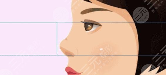 自體軟骨隆鼻好嗎？有什么優(yōu)勢(shì)？手術(shù)注意事項(xiàng)建議要銘記于心！