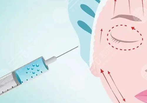 瑞蘭2號(hào)玻尿酸多少錢？