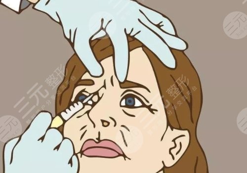 瑞蘭2號(hào)玻尿酸多少錢？