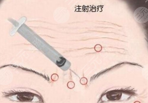 瑞蘭2號(hào)玻尿酸多少錢？