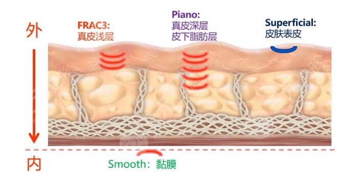 臉部吸脂的價格影響因素有哪些？