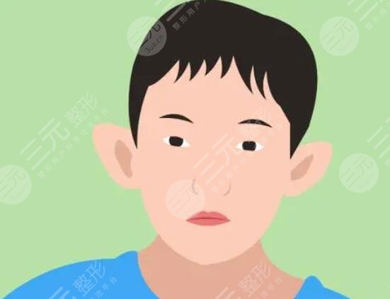 招風(fēng)耳整形風(fēng)險(xiǎn)大嗎？招風(fēng)耳整形手術(shù)效果怎么樣？怎么正確的做好術(shù)后護(hù)理？