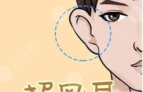 招風(fēng)耳整形風(fēng)險(xiǎn)大嗎?