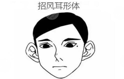 招風(fēng)耳整形效果好不好?