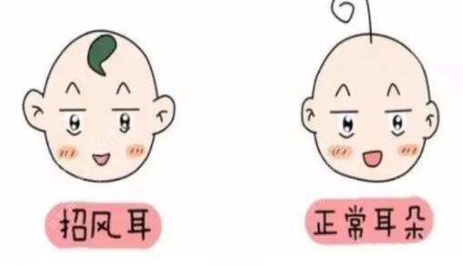 招風(fēng)耳整形需要注意什么呢?