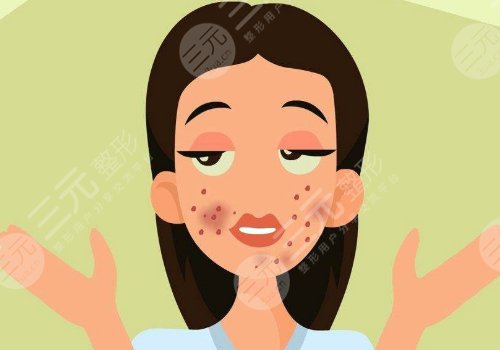 激光祛痘坑痘印有沒有危害?