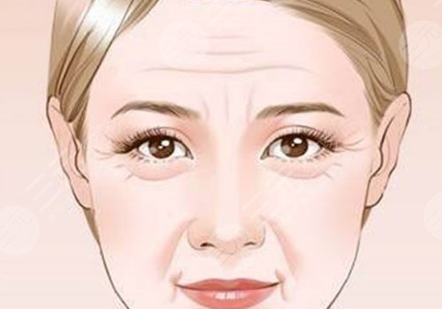 射頻除皺能維持多久?