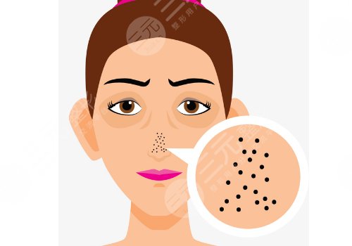 黑頭導(dǎo)出液真的有用嗎?