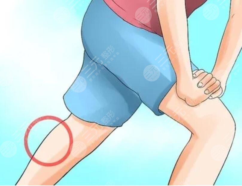 小腿吸脂手術(shù)價格多少錢2023？手術(shù)注意事項說明，擁有漫畫版修長腿！