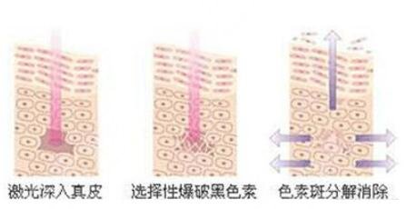 影響黑臉娃娃價格的因素