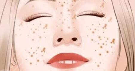 激光祛斑的注意事項