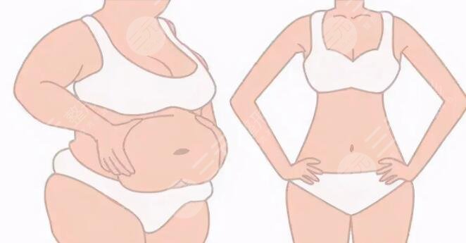 關(guān)于減肥的好方法哪些見效？