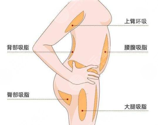 減肥期間應(yīng)該注意些什么