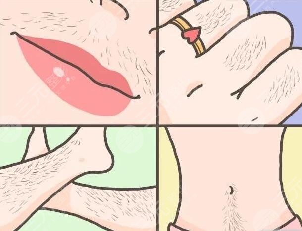 小腿激光脫毛的注意事項