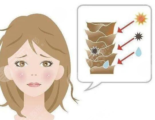 光子嫩膚去雀斑費用貴不貴?