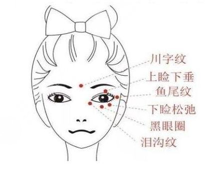 激光除皺|緩解魚?尾紋的原理是什么?