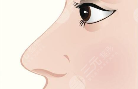 鼻子整形可以維持一輩子嗎？10年、20年后怎么辦？鼻科醫(yī)生告訴你實情！