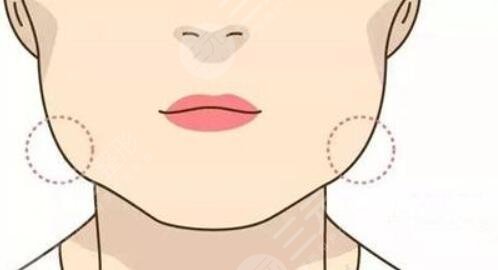 削骨瘦臉前后對(duì)比照大公開(kāi)！對(duì)臉型的改變可能會(huì)出乎意料！變小臉~