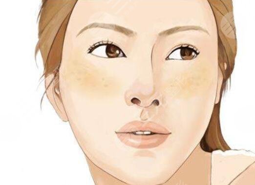 激光緩解黃褐斑多少錢一個療程？技術(shù)原理剖析，術(shù)后護理注意事項告知！